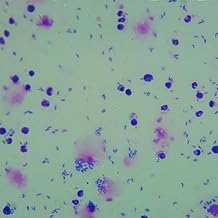 1 Piece Toxoplasma Gondii Trophozoites W.M Parasitology Parasite Prepared Slides