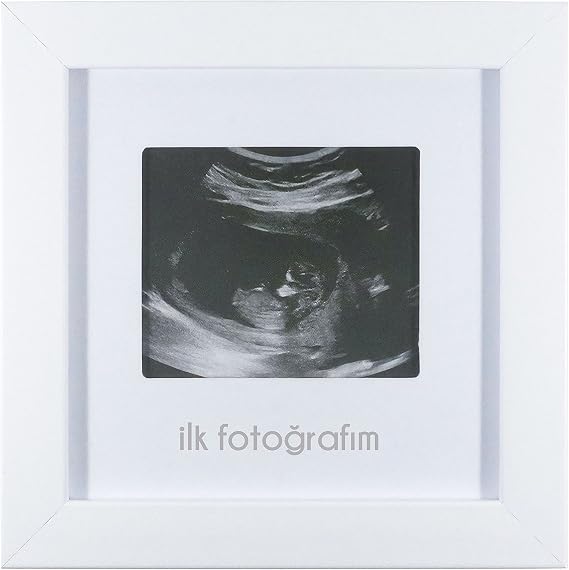 FUFIZU My First Photo إطار الموجات فوق الصوتية للأطفال - إطار ذاكرة صورة غرفة الأطفال